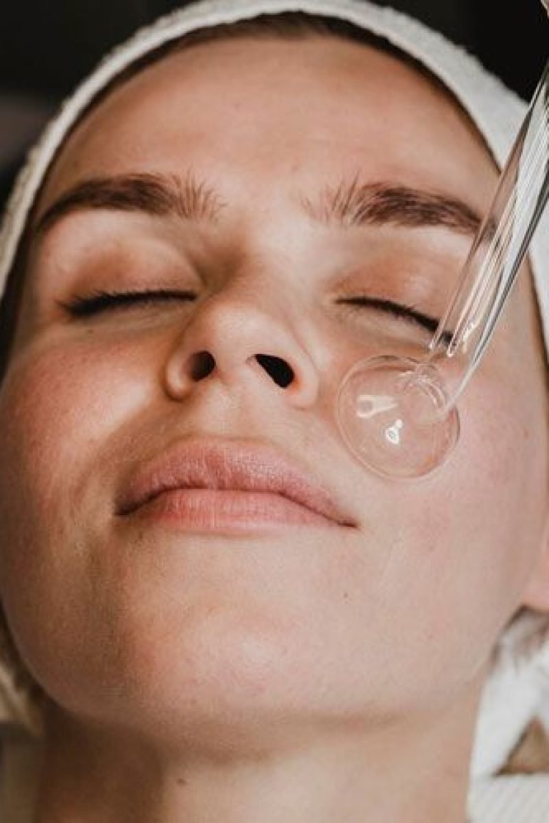 co2-fractional-laser